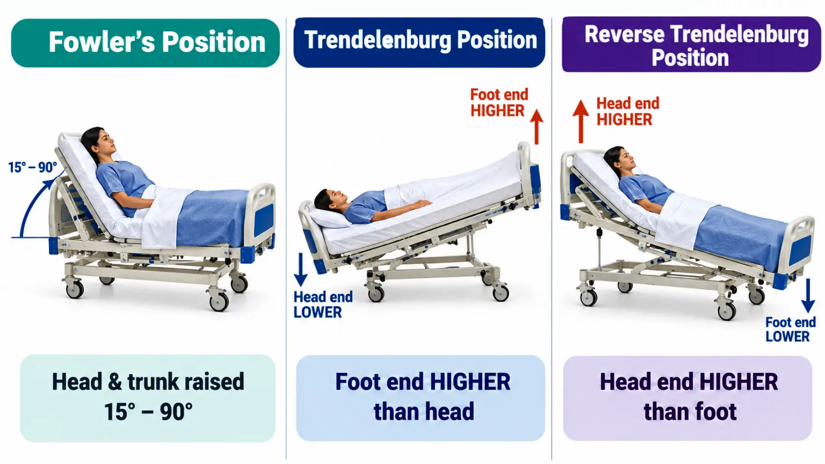 Fowler’s, Trendelenburg and Reverse Trendelenburg positions