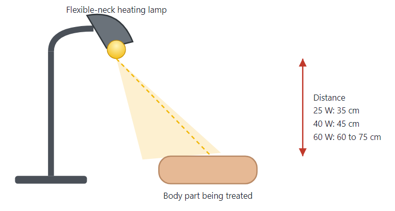 Illustration: heating lamp placed at the recommended distance (treatment 20 to 30 minutes)